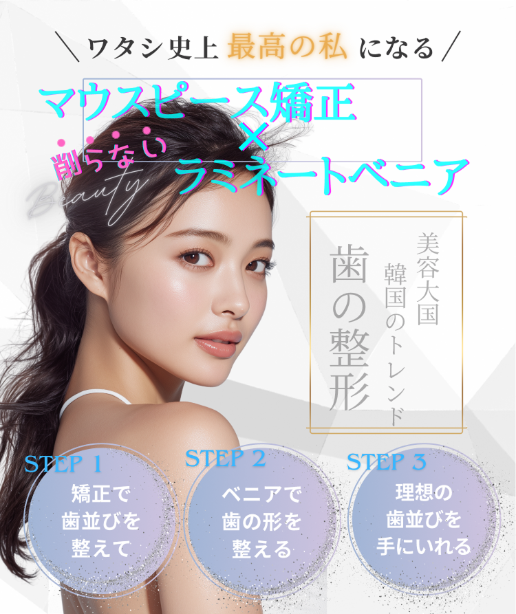 ラミネートべニア